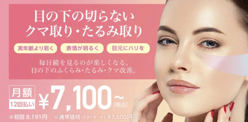 TCB東京中央美容外科の目の下の切らないクマ取りを実際に受けた方の症例画像（ビフォーアフター）
