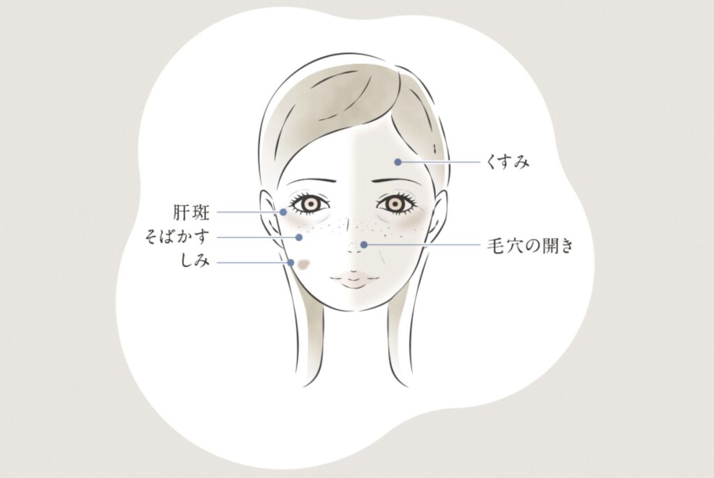 TCB東京中央美容外科のよるシミ取り治療で改善できる症状